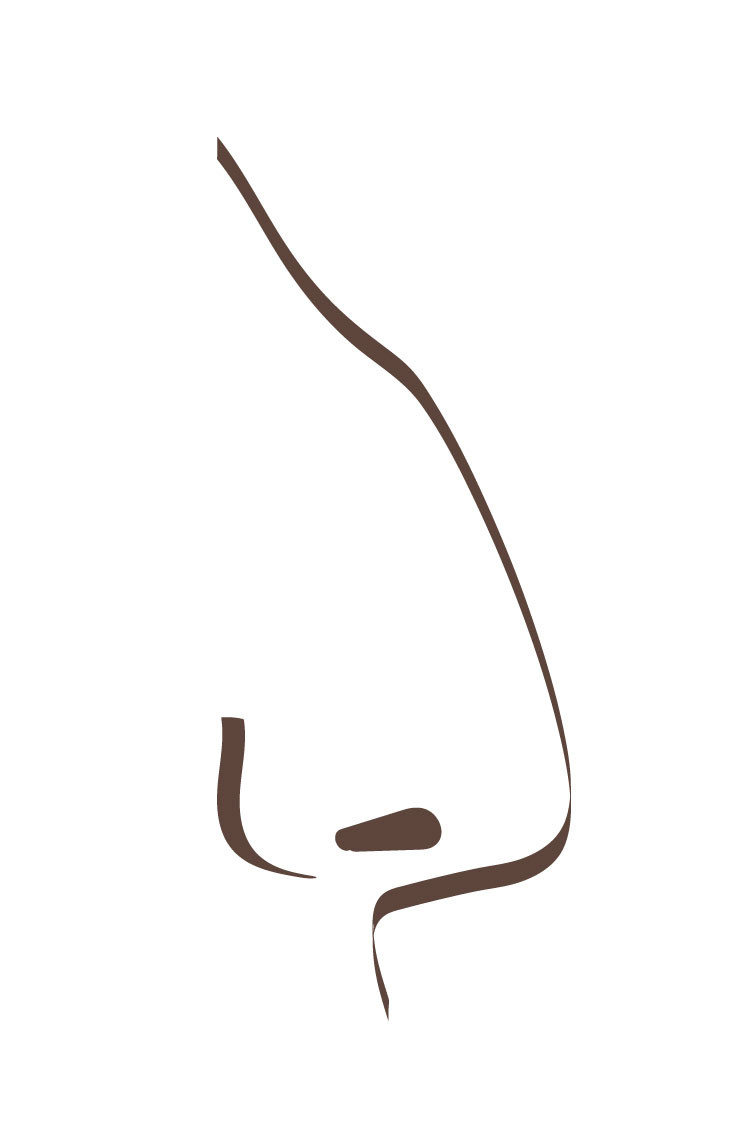 Grafik einer Höckernase