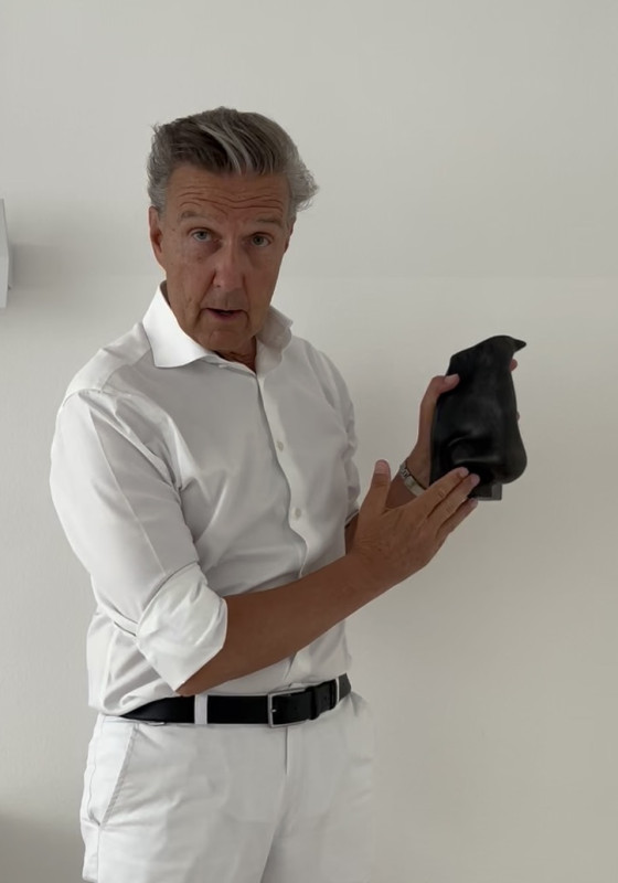 Prof. Dr. Holtmann erklärt an einem Nasenmodell die Nasenscheidewand